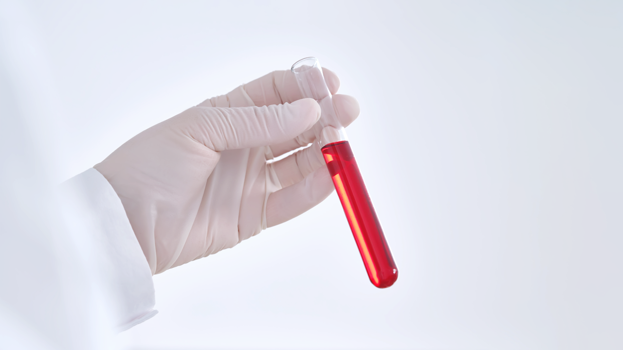 MDS TOTAL 건강검진