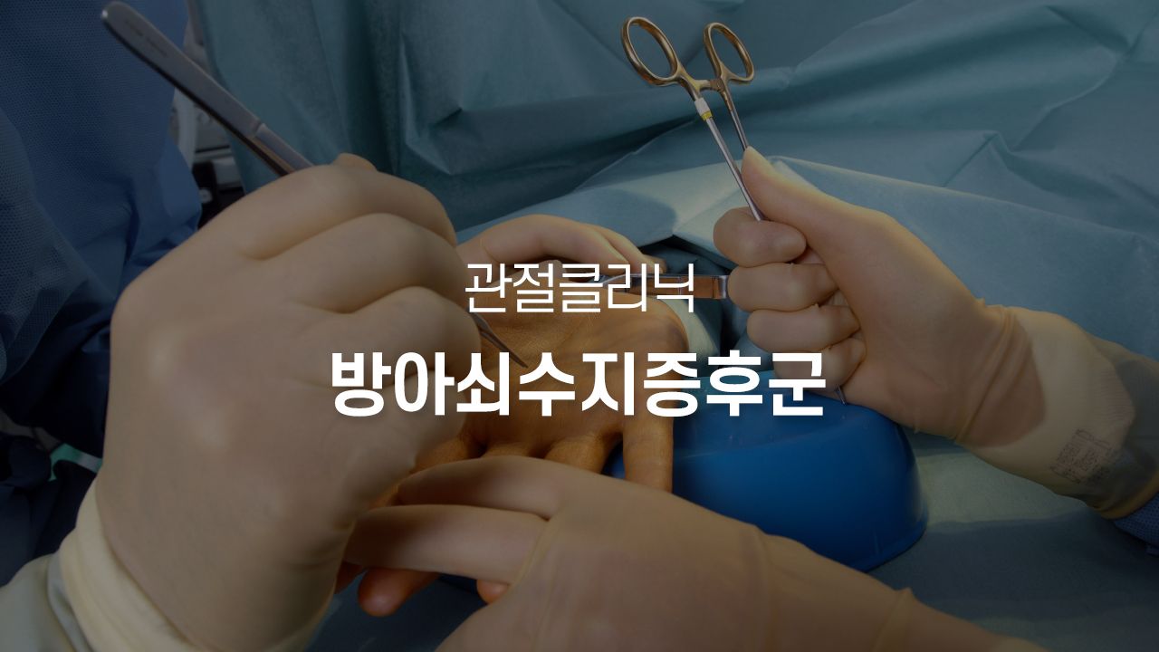 방아쇠수지증후군