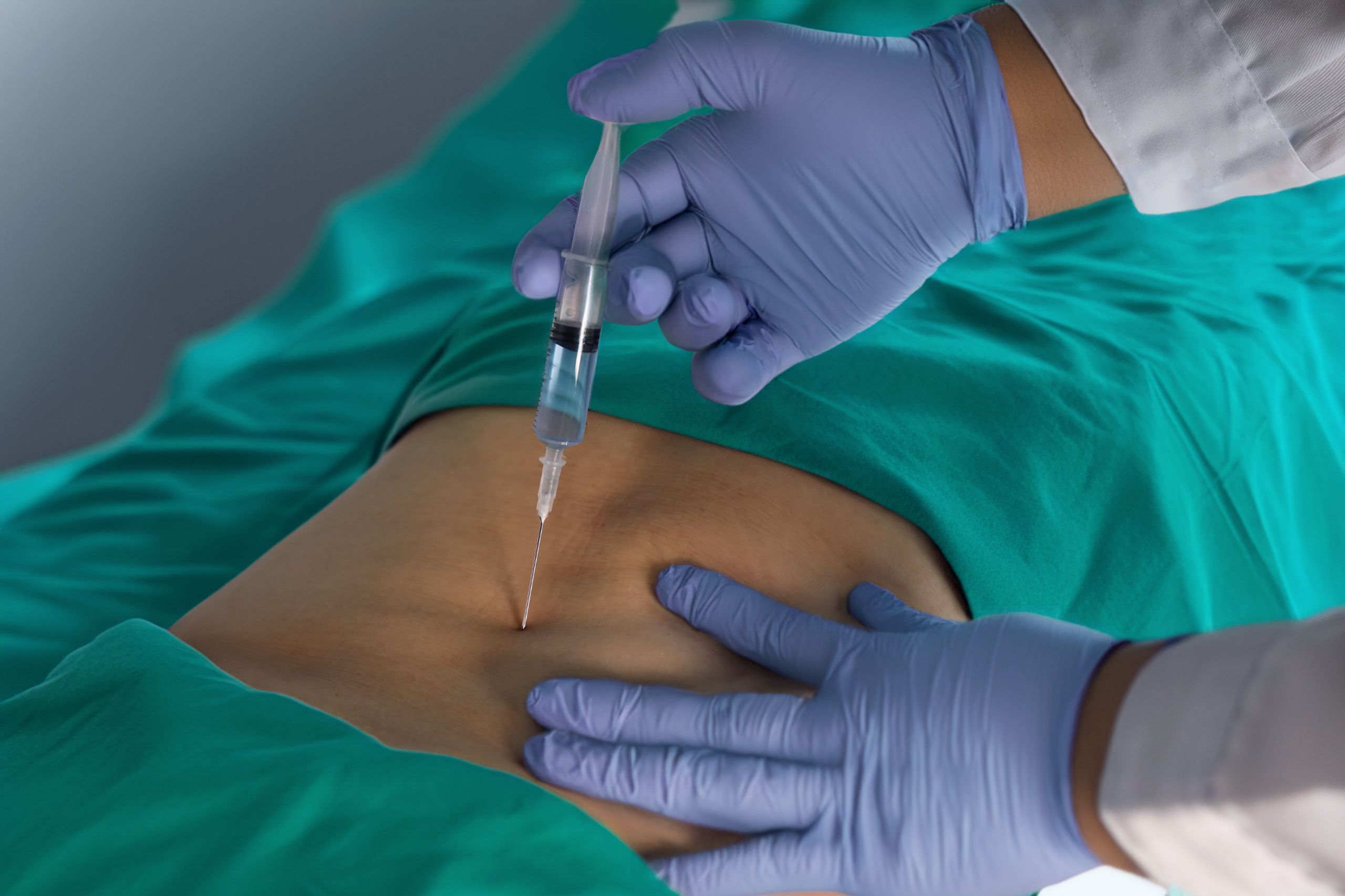 비수술 척추치료, 신경차단술이란?