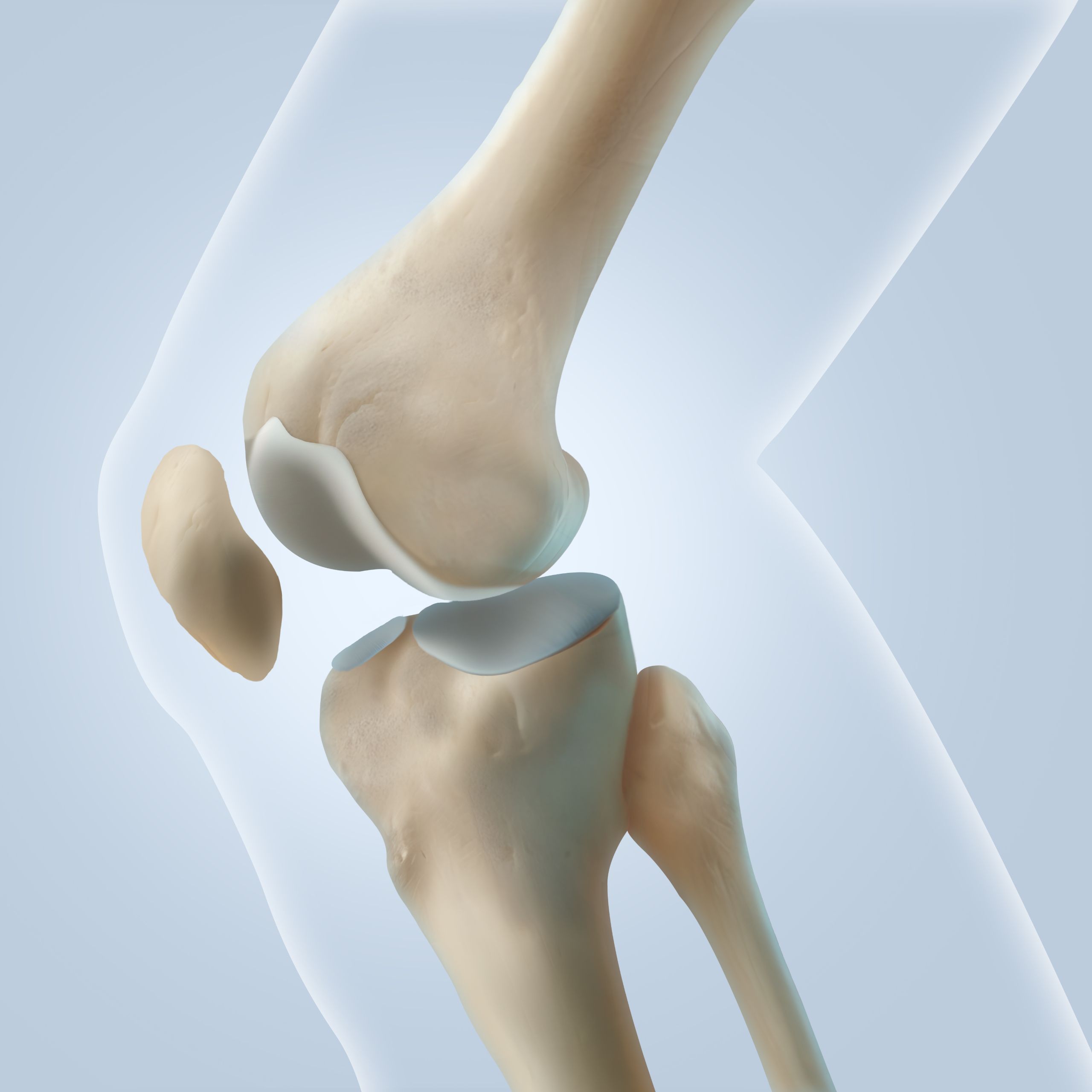 슬개골 골절이란? 무릎을 다쳤다면 꼭 확인해야 할 정보